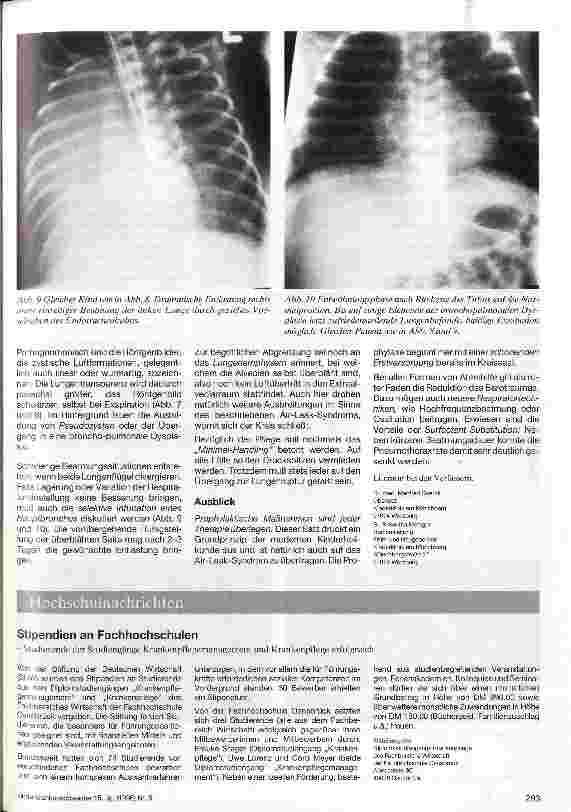 Vorschauseite 4: Intensivmedizinisches und pflegerisches Management beim Air-Leak-Syndrom