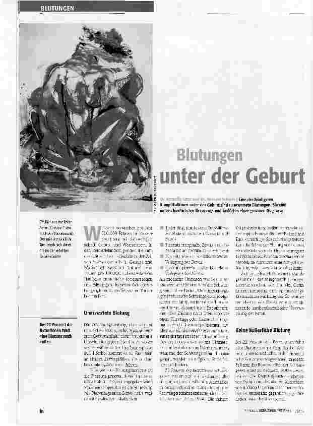 Vorschauseite 1: Blutungen unter der Geburt