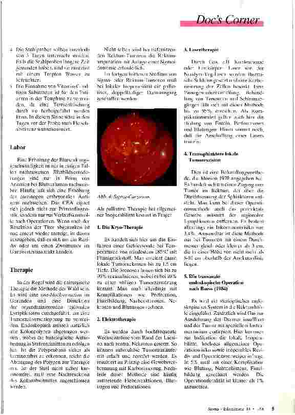 Vorschauseite 3: Keine guten Aussichten Das Koloncarzinom