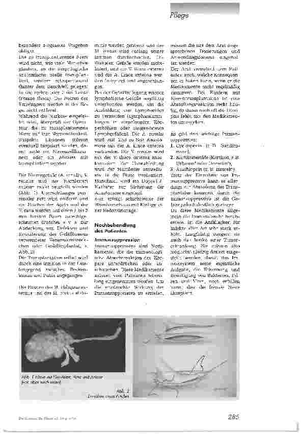Vorschauseite 2: Der weite Weg des Spenderorgans2. Teil: Ablauf einer Organtransplantation am Beispiel der Nierentransplantation