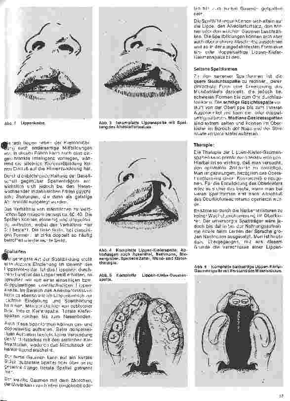 Vorschauseite 2: Zahn-Mundund Kieferchirurgie 7. Folge: Lippen-, Kiefer-, Gaumenspalten