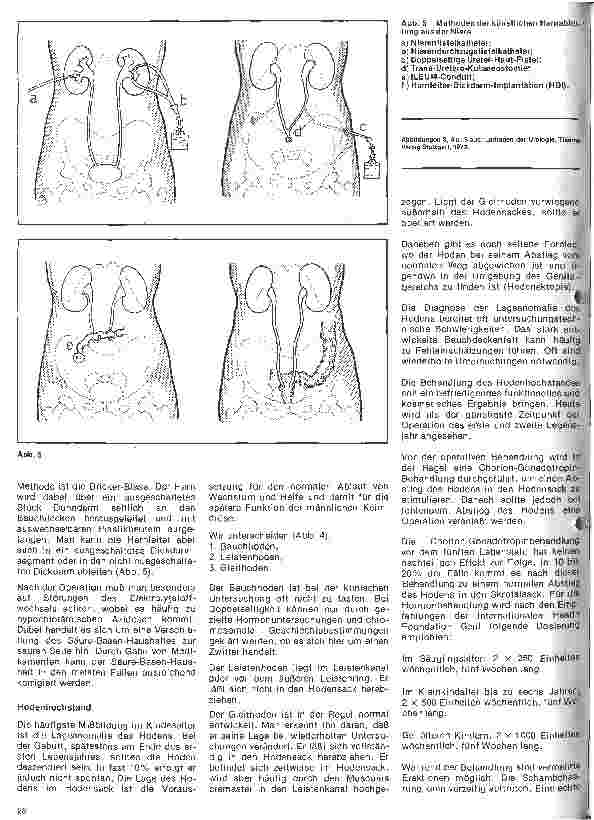 Vorschauseite 5: Urologie 10. Folge: Urologie im Kindesalter (I)