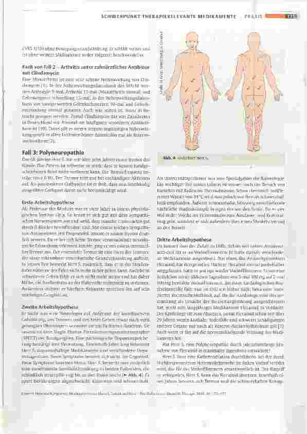 Vorschauseite 4: Nebenwirkungen von Medikamenten an Muskel, Gelenk und Nerv Drei Fallberichte
