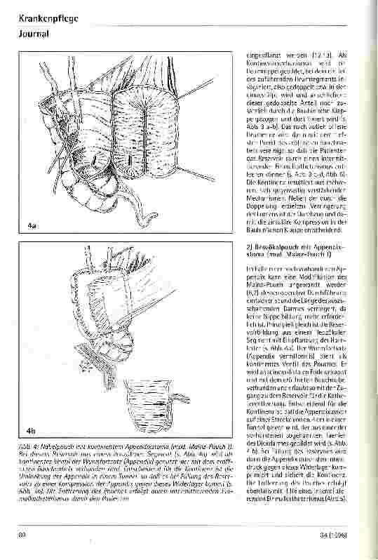 Vorschauseite 5: Operative Konzepte des kontinenten Harnblasenersatzes