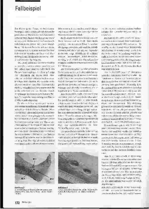 Vorschauseite 3: Heilung und Gewebe-Regeneration bei einer therapieresistenten, hypoxischen Bein-Ulzeration mit Hilfe von Hämoglobin und intermittierter systemischer normobarer Oxygenation