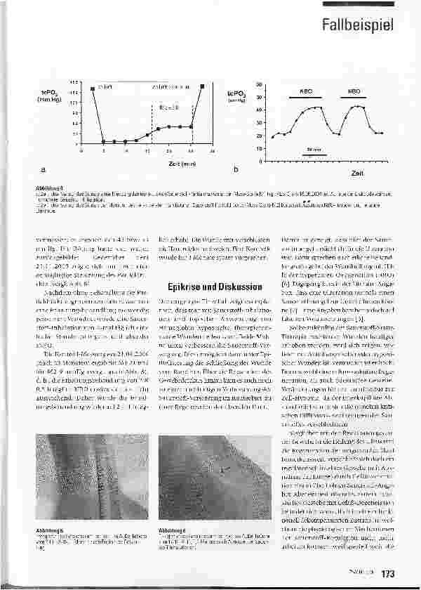 Vorschauseite 4: Heilung und Gewebe-Regeneration bei einer therapieresistenten, hypoxischen Bein-Ulzeration mit Hilfe von Hämoglobin und intermittierter systemischer normobarer Oxygenation
