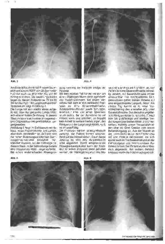 Vorschauseite 2: Respiratorische Insuffizienz - Schocklunge