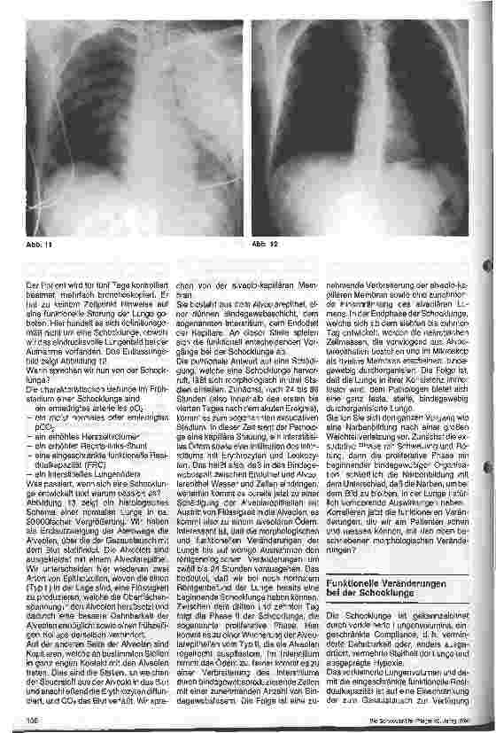 Vorschauseite 4: Respiratorische Insuffizienz - Schocklunge