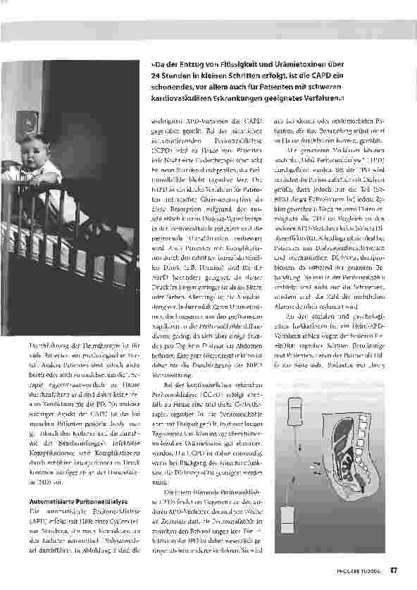Vorschauseite 2: Peritonealdialyse -State of the Art