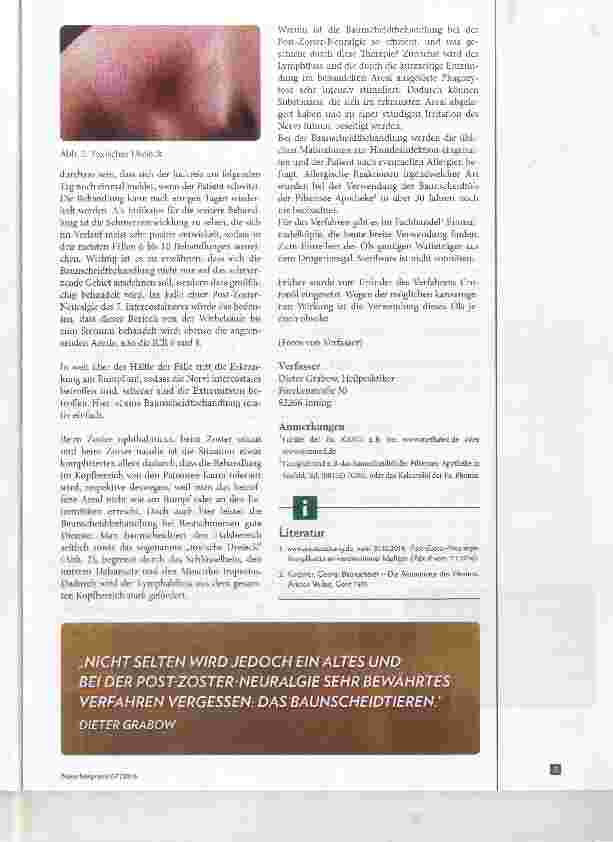 Vorschauseite 2: Baunscheidtieren bei Post-Zoster-Neuralgie