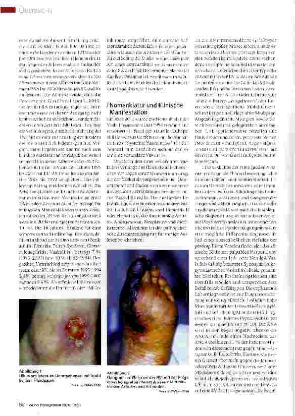 Vorschauseite 2: Rheumatoide Vaskulitis