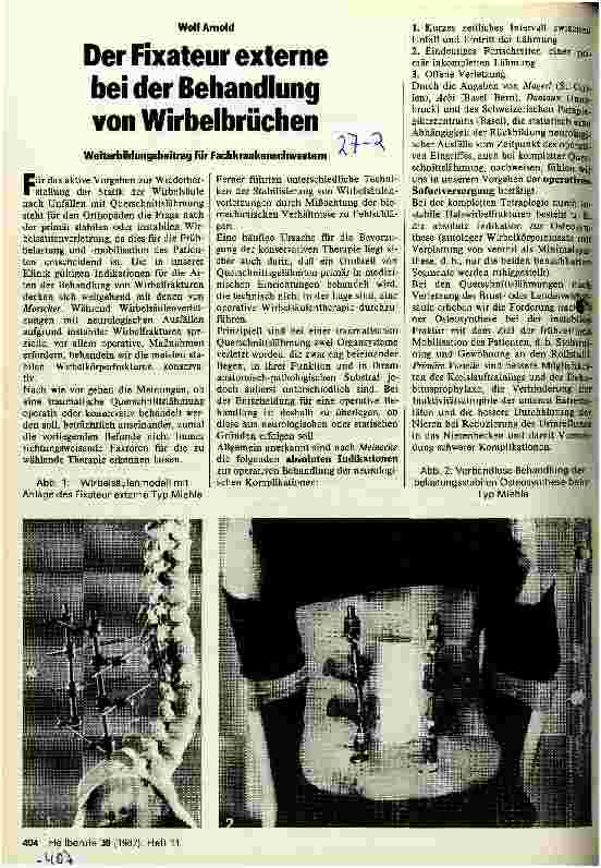 Vorschauseite 1: Der Fixateur externe bei der Behandlung von Wirbelbrüchen