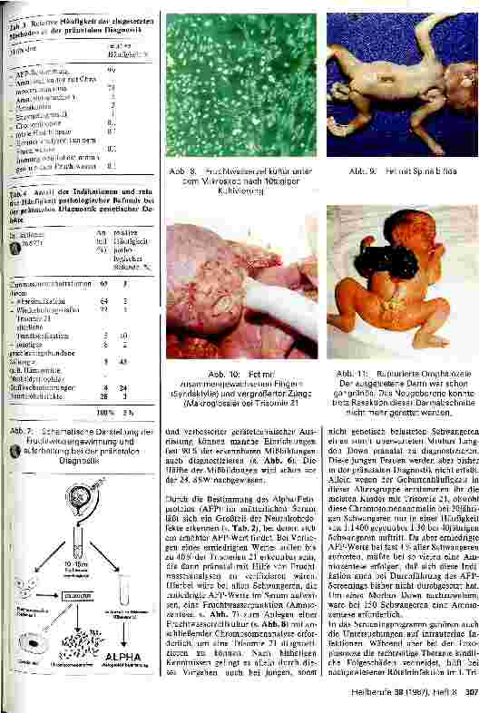 Vorschauseite 3: Allgemeine geburtshilfliche Aspekte zur Vermeidung angeborener Anomalien