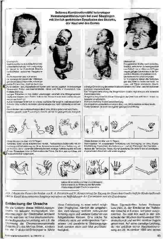 Vorschauseite 2: 25 Jahre Thalidomid-Embryopathie Rückbesinnung auf Arzneimittelrisiken