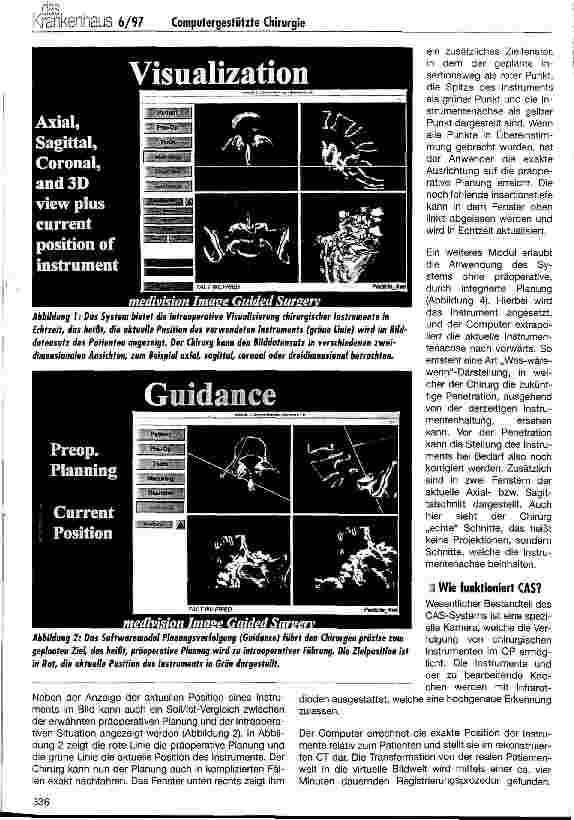 Vorschauseite 2: Computergestützte Chirurgie: Planung, Simulation, Navigation