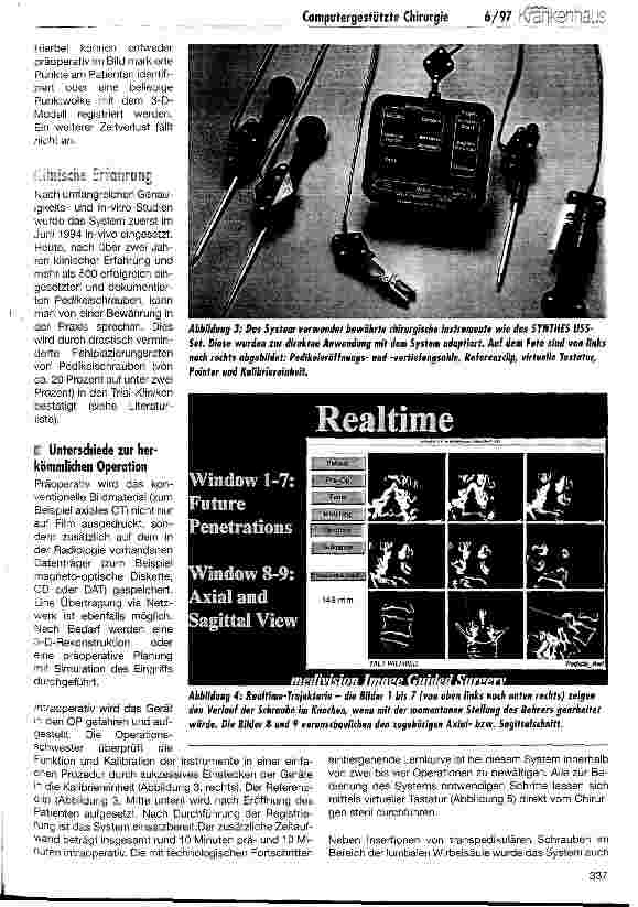 Vorschauseite 3: Computergestützte Chirurgie: Planung, Simulation, Navigation