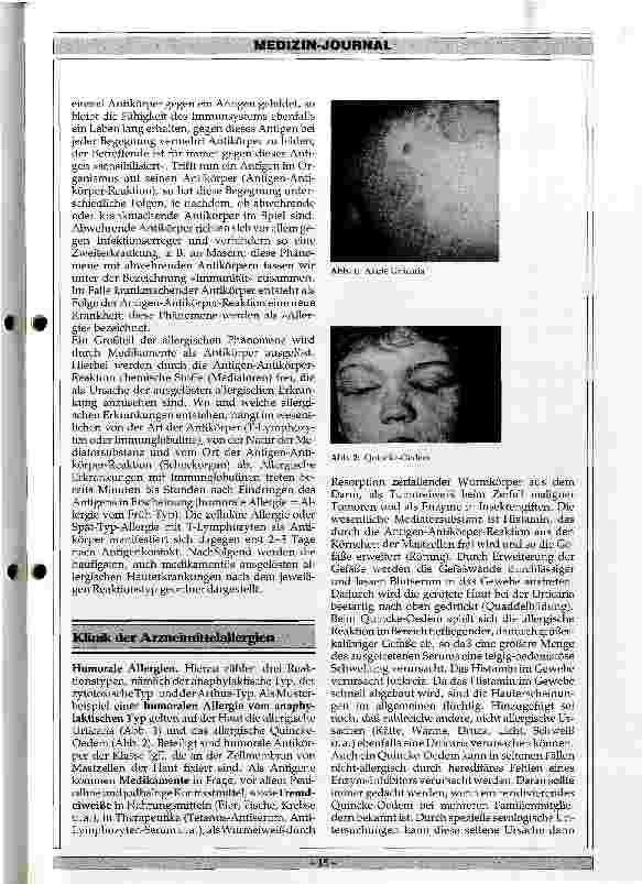 Vorschauseite 2: Klinik und Therapie der Arzneimittelallergien