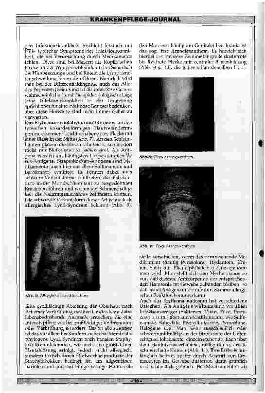 Vorschauseite 5: Klinik und Therapie der Arzneimittelallergien