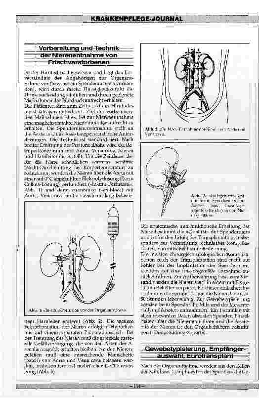 Vorschauseite 4: Nierentransplantationen 1987