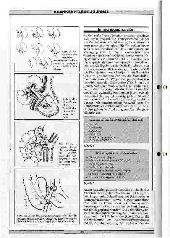 Vorschauseite 6: Nierentransplantationen 1987
