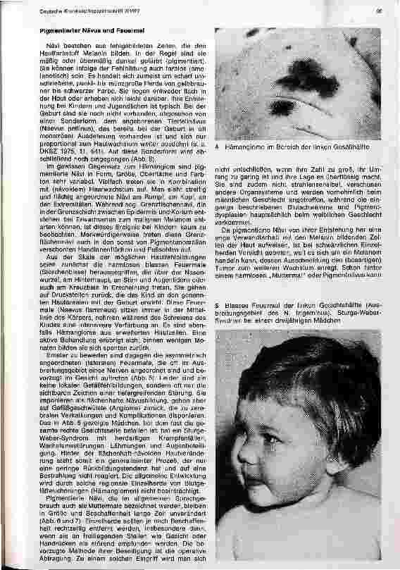 Vorschauseite 3: Hämangiome, Feuermale und Pigmentzellwucherungen