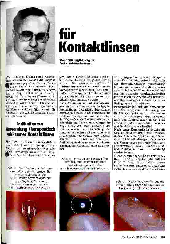 Vorschauseite 2: Therapeutische Anwendungsmöglichkeiten für Kontaktlinsen