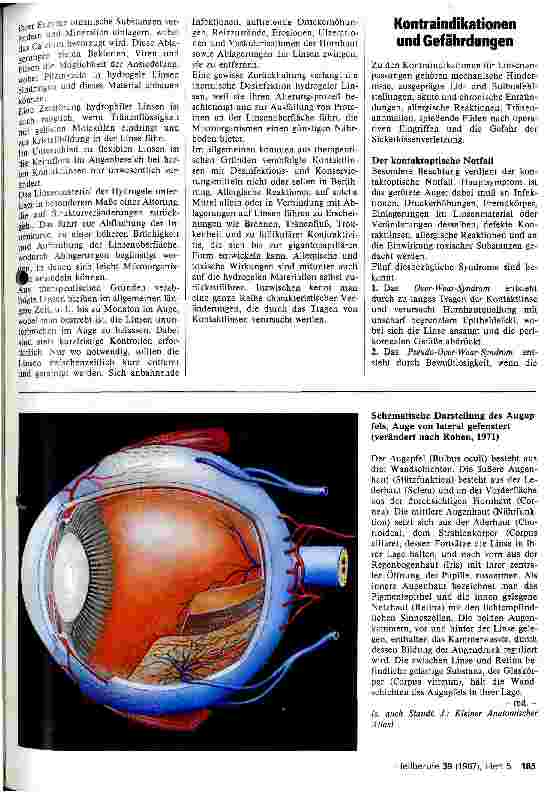 Vorschauseite 4: Therapeutische Anwendungsmöglichkeiten für Kontaktlinsen