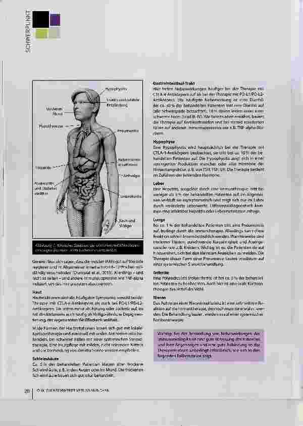 Vorschauseite 2: Nebenwirkungsmanagement bei Immunonkologika Pflegerische Aspekte bei Patienten mit Hauttumoren