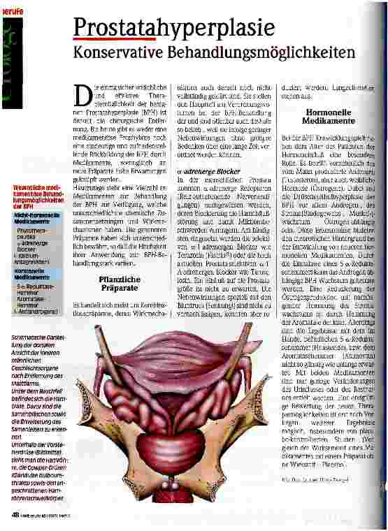 Vorschauseite 1: Prostatahyperplasie Konservative Behandlungsmöglichkeiten