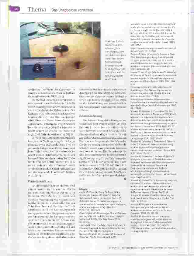 Vorschauseite 5: Intrauterine fetale Chirurgie