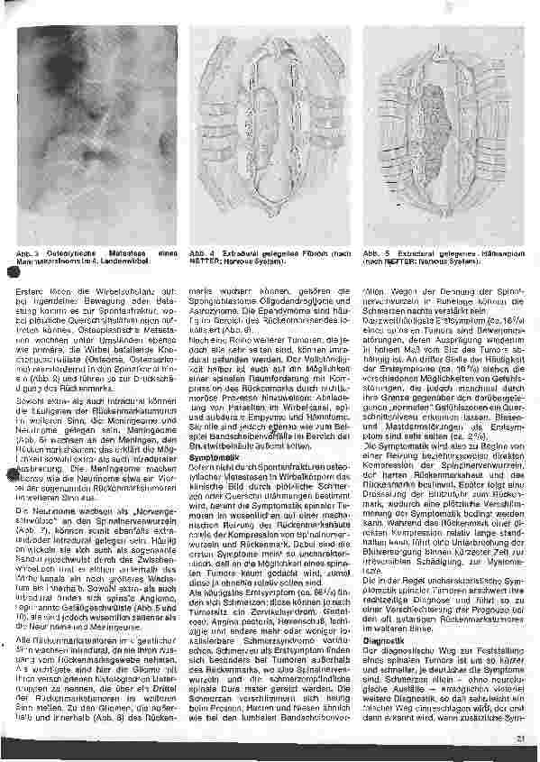 Vorschauseite 2: Themen aus der Neurochirurgie 6. Folge: Spinale Tumoren