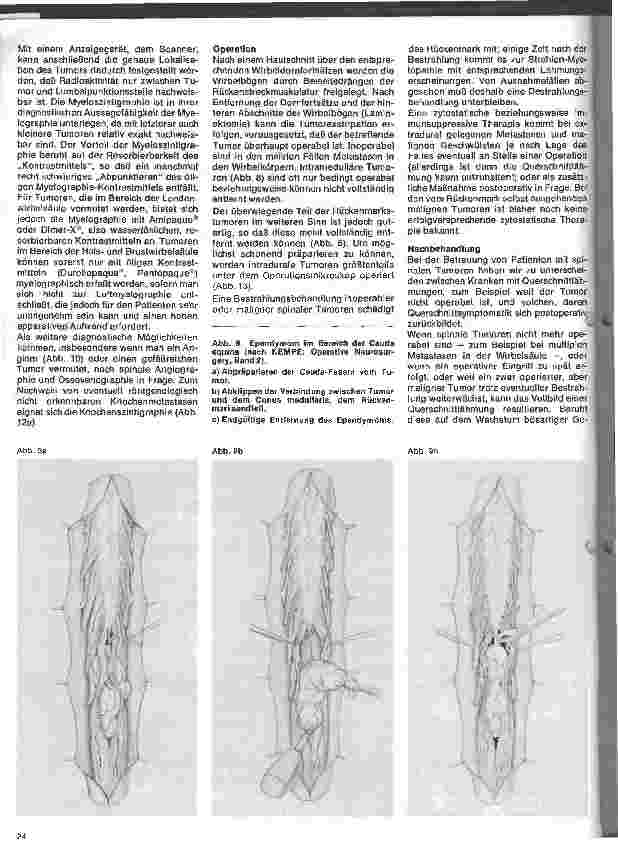 Vorschauseite 4: Themen aus der Neurochirurgie 6. Folge: Spinale Tumoren