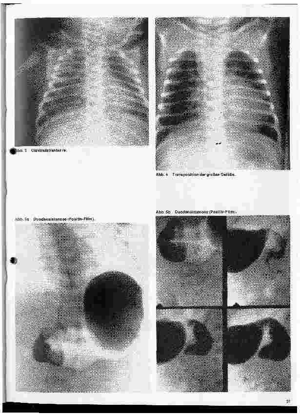 Vorschauseite 2: Radiologie 33. Folge: Röntgenuntersuchungen im Kindesalter