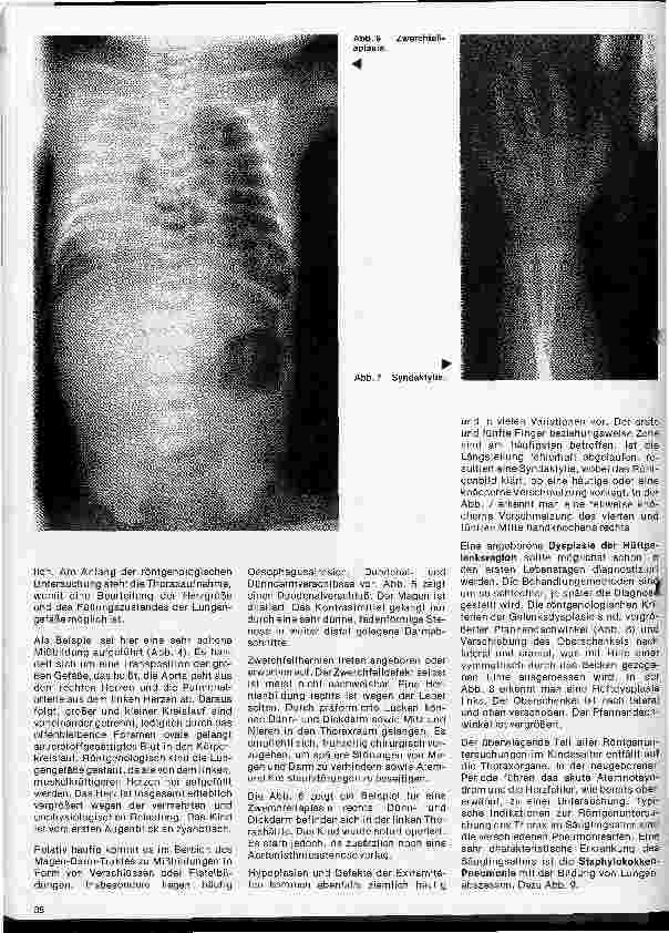 Vorschauseite 3: Radiologie 33. Folge: Röntgenuntersuchungen im Kindesalter