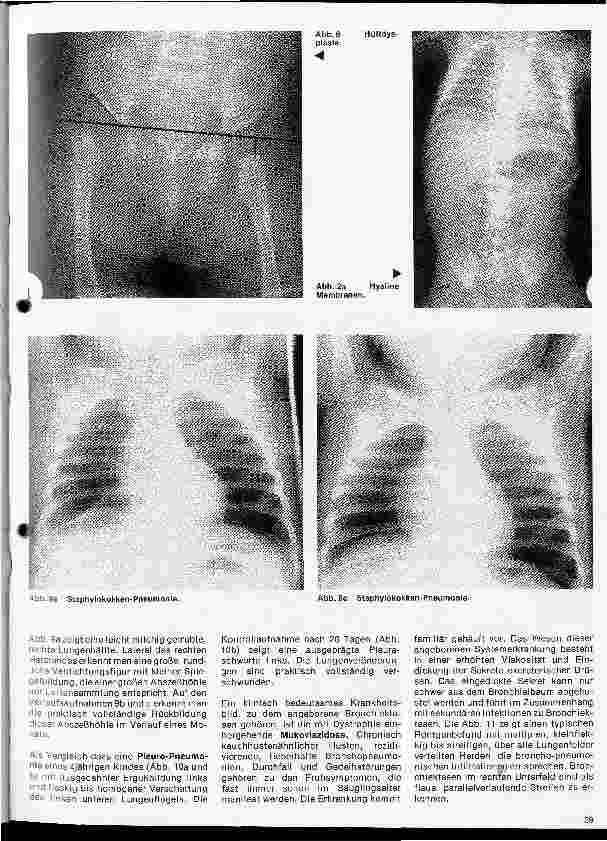 Vorschauseite 4: Radiologie 33. Folge: Röntgenuntersuchungen im Kindesalter