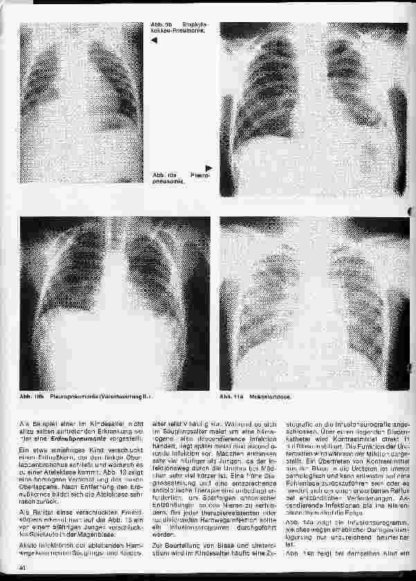 Vorschauseite 5: Radiologie 33. Folge: Röntgenuntersuchungen im Kindesalter