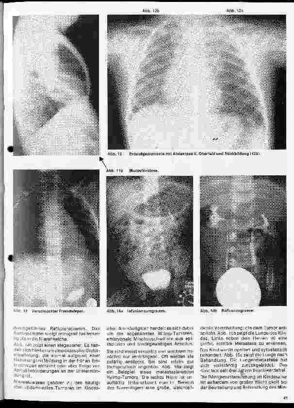 Vorschauseite 6: Radiologie 33. Folge: Röntgenuntersuchungen im Kindesalter