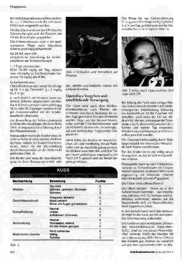 Vorschauseite 3: Perioperative Betreuung von Kindern mit Lippen-Kiefer-Gaumenspalten