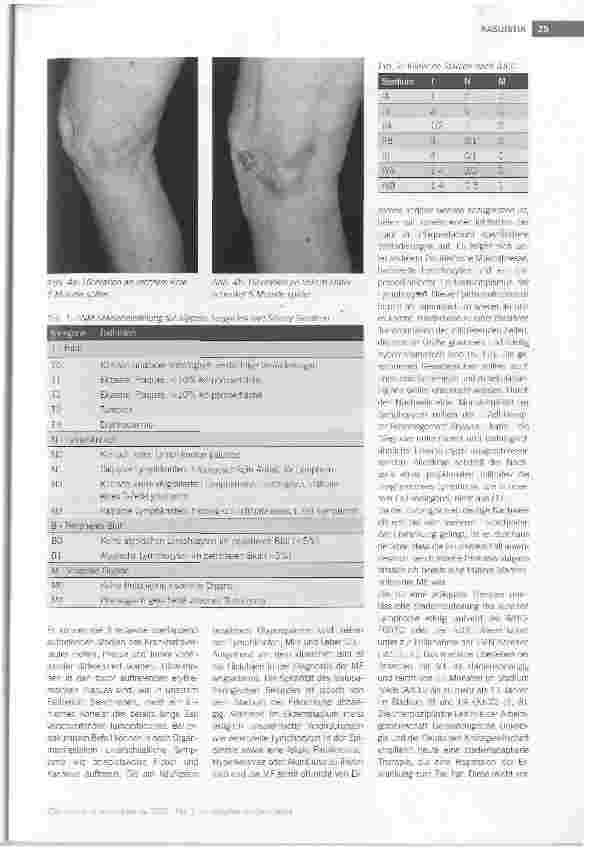 Vorschauseite 3: KASUISTIK Mycosis fungoides - eine seltene Ursache chronischer Wunden