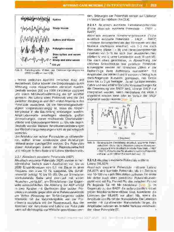 Vorschauseite 3: Elektroenzephalogramm und evozierte Potenziale in der Intensivmedizin