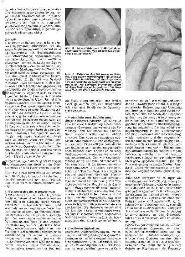 Vorschauseite 6: Einführung in die Augenheilkunde 9. Folge: Das Glaukom - Der grüne Star
