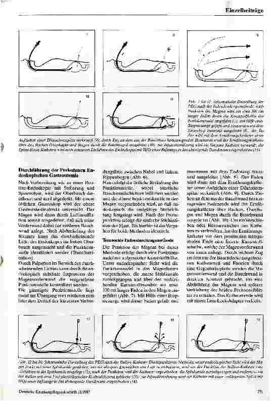 Vorschauseite 3: Neue Techniken der längerfristigen Sondenernährung