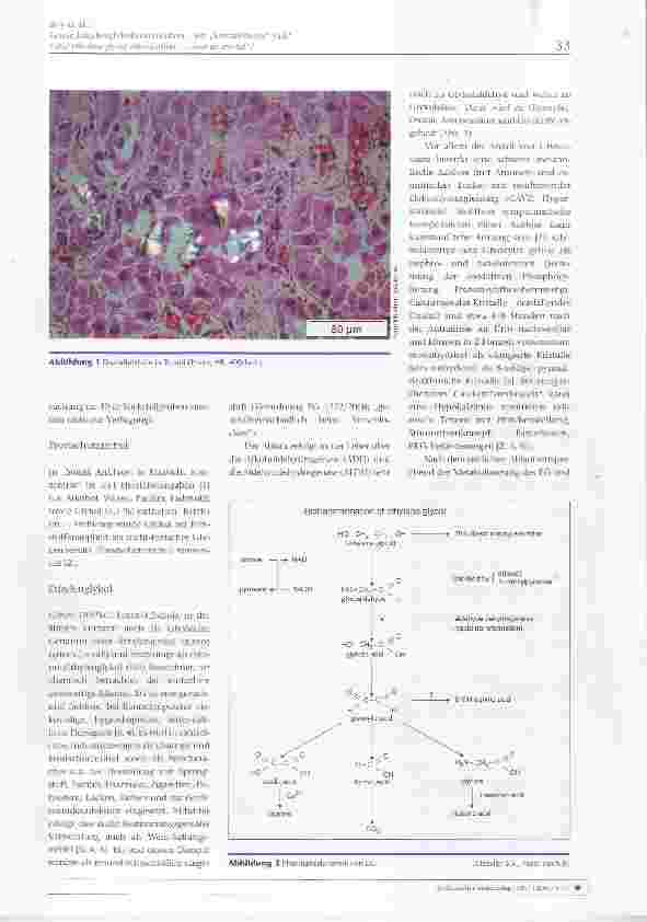 Vorschauseite 3: Letale Ethylenglykolintoxikation ein „kristallklarer Fall?