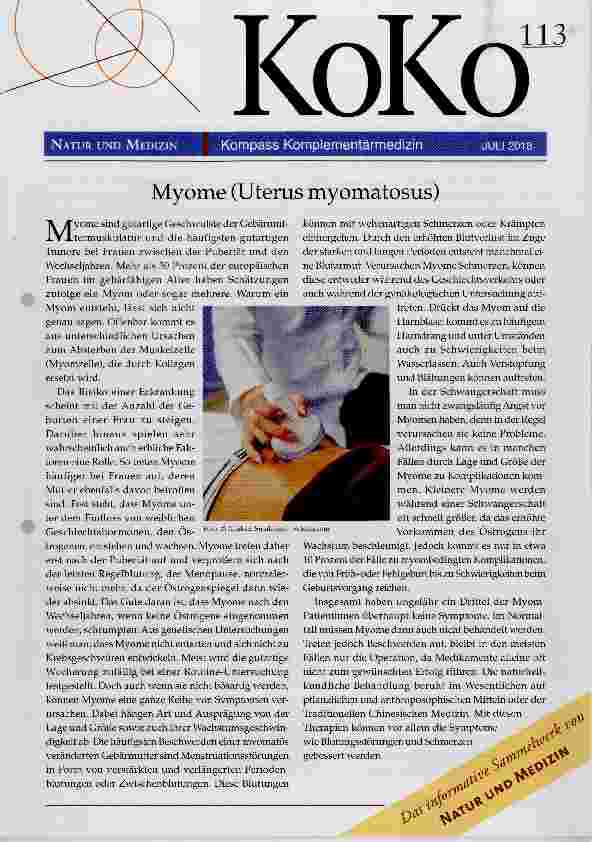 Vorschauseite 1: Myome (Uterus myomatosus)