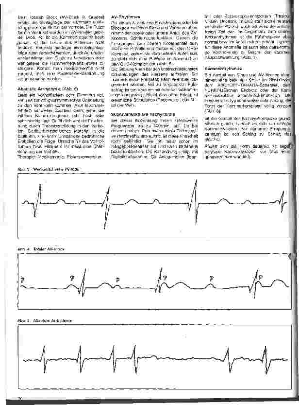 Vorschauseite 3: Schwerstkranke Kinder mit angeborenen Herzfehlern 5. Folge: Das Monitor-EKG