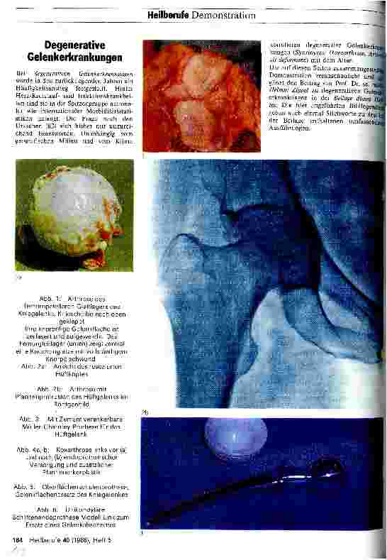 Vorschauseite 1: Degenerative Gelenkerkrankungen