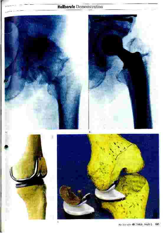 Vorschauseite 2: Degenerative Gelenkerkrankungen