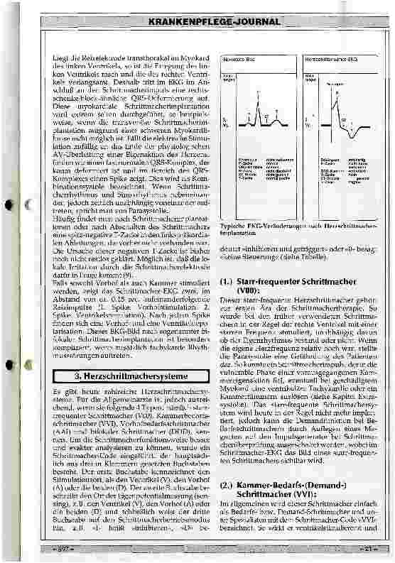 Vorschauseite 2: Herzschrittmacher-EKG