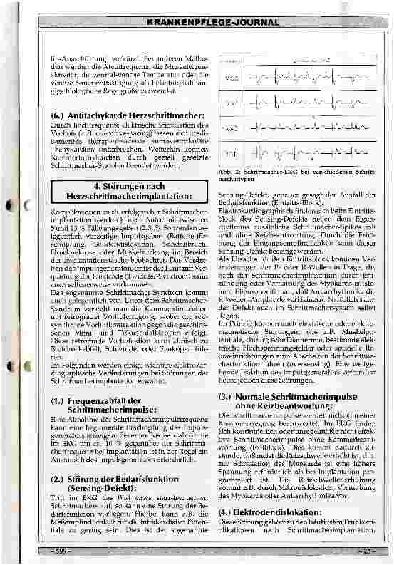 Vorschauseite 4: Herzschrittmacher-EKG