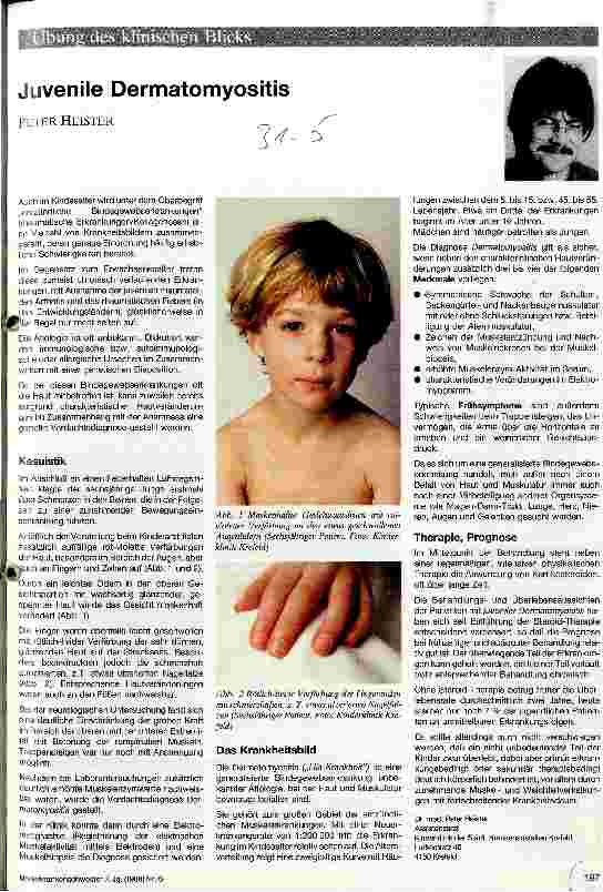 Vorschauseite 1: Juvenile Dermatomyositis